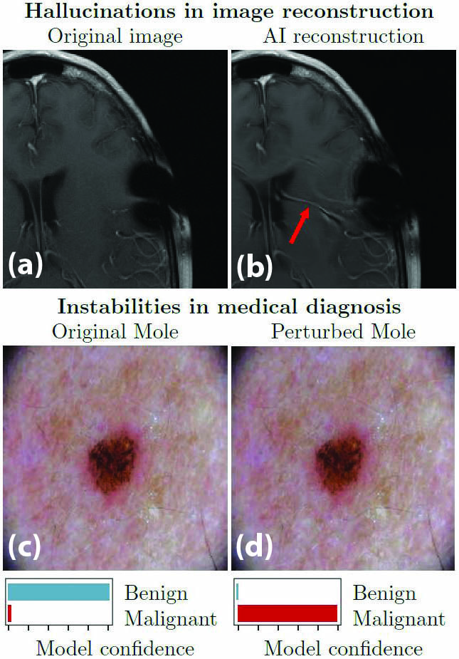 &lt;strong&gt;Figure 1.&lt;/strong&gt; Hallucinations in image reconstruction and instabilities in medical diagnoses. &lt;strong&gt;1a.&lt;/strong&gt; The correct, original image from the 2020 fastMRI Challenge. &lt;strong&gt;1b.&lt;/strong&gt; Reconstruction by an artificial intelligence (AI) method that produces an incorrect detail (AI-generated hallucination). &lt;strong&gt;1c.&lt;/strong&gt; Dermatoscopic image of a benign melanocytic nevus, along with the diagnostic probability computed by a deep neural network (NN). &lt;strong&gt;1d.&lt;/strong&gt; Combined image of the nevus with a slight perturbation and the diagnostic probability from the same deep NN. One diagnosis is clearly incorrect, but can an algorithm determine which one? Figures 1a and 1b are courtesy of the 2020 fastMRI Challenge [10], and 1c and 1d are courtesy of [6].