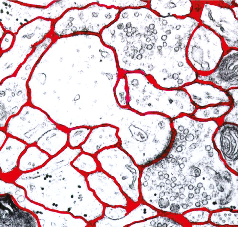&lt;strong&gt;Figure 2.&lt;/strong&gt; Cells in the brain lie in extracellular fluid (ECF). The fluid is coloured red. Image courtesy of [3].