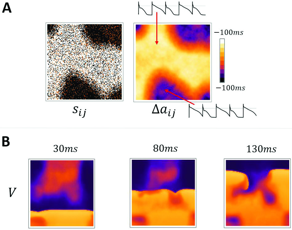&lt;strong&gt;Figure 2.&lt;/strong&gt; The dynamics of calcium (Ca) waves and voltage in cardiac tissue. &lt;strong&gt;2a.&lt;/strong&gt; At steady state, the order parameter \(s_{ij}\) that measures the phase of the alternating waves can synchronize across large patches of cardiac tissue. Here, black regions denote cells with \(s_{ij}=1\) and white regions denote cells with \(s_{ij}=-1\). Orange points denote cells wherein no Ca wave occurs. This pattern then drives spatial patterns of voltage that are quantified by the action potential amplitude \(\Delta a_{ij}\), which measures beat-to-beat differences in the voltage time course. &lt;strong&gt;2b.&lt;/strong&gt; When the same tissue is paced from the bottom edge, planar waves undergo wave break that is caused by the spatial patterns that form due to the synchronization transition. Here we simulate a piece of cardiac tissue that consists of a \(150 \times 150\) cell grid. The wave break occurs after 30 beats when the spatial patterns have developed. Figure courtesy of [3].