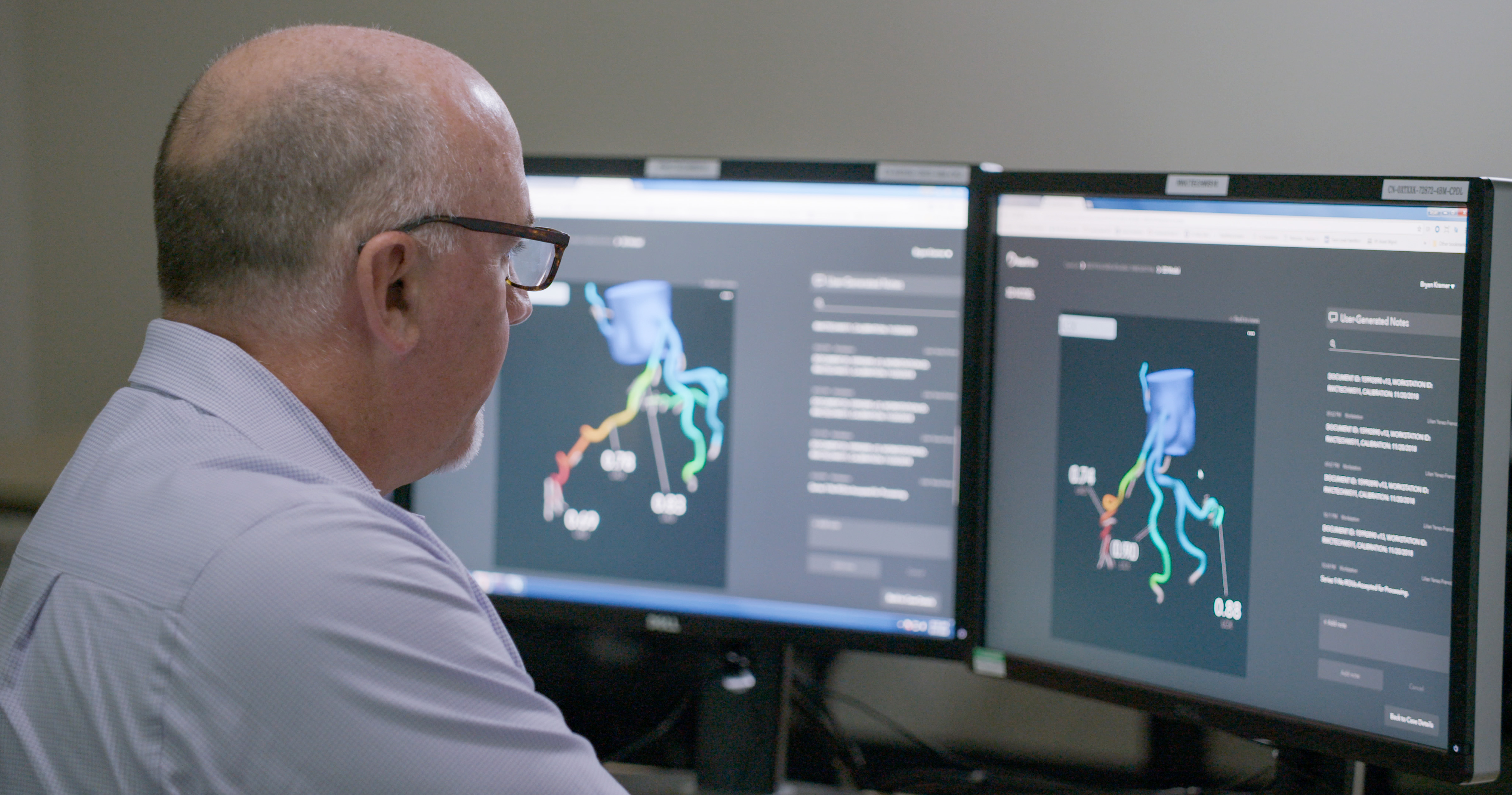 &lt;strong&gt;Figure 1.&lt;/strong&gt; HeartFlow cofounder and chief technology officer Charles Taylor reviews a HeartFlow Analysis three-dimensional model. Figure courtesy of HeartFlow.