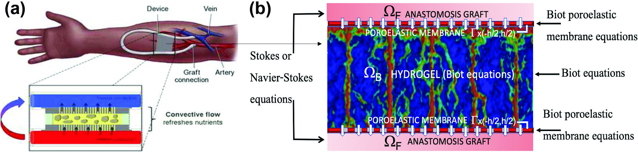 &lt;strong&gt;Figure 1.&lt;/strong&gt; A sketch of a bioartificial pancreas. &lt;strong&gt;1a.&lt;/strong&gt; Schematic illustration of an anastomosis graft that connects the encapsulation device to the host vasculature. &lt;strong&gt;1b.&lt;/strong&gt; Encapsulation device that depicts the poroelastic hydrogel scaffold, encapsulating membranes, and part of the anastomosis graft. Figure 1a courtesy of Shuvo Roy and 1b courtesy of Sunčica Čanić.