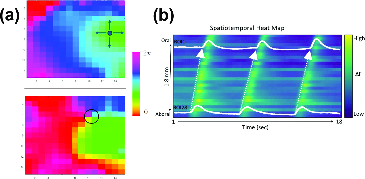 <strong>Figure 1.</strong> Examples of spatially organized oscillations in biological systems. <strong>1a.</strong> Local field potential recordings from a grid of implanted electrodes on a human cortex at two different epochs. <strong>1b.</strong> Cellular calcium activity across the proximal colon of a mouse indicates organized, small-amplitude ripple contractions. Figure 1a adapted from [1]  and 1b courtesy of the author.