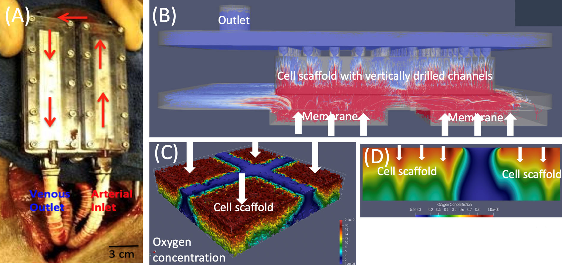 &lt;strong&gt;Figure 2.&lt;/strong&gt; Implantable bioartificial pancreas (iBAP). &lt;strong&gt;2a.&lt;/strong&gt; The iBAP prototype device in a porcine model. &lt;strong&gt;2b.&lt;/strong&gt; Streamlines that depict flow direction and magnitude. Red indicates a high level of flow, and white and blue indicate low levels. &lt;strong&gt;2c.&lt;/strong&gt; A three-dimensional (3D) simulation of oxygen concentration in the scaffold. Red signifies a high level of oxygen, and cyan and blue signify low levels. &lt;strong&gt;2d.&lt;/strong&gt; A two-dimensional slice of the 3D simulation in 2c. White arrows denote flow direction. Figure 2a courtesy of Shuvo Roy and 2b-2d courtesy of Sunčica Čanić.