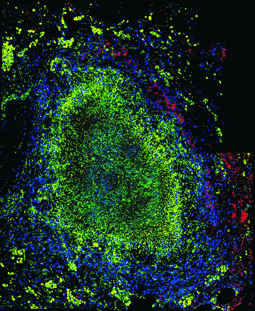 &lt;strong&gt;Figure 1.&lt;/strong&gt; Non-human primate granuloma. Figure courtesy of the laboratory of JoAnne Flynn at the University of Pittsburgh.