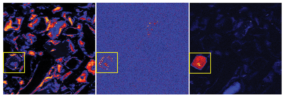 <strong>Figure 1.</strong> Selected element distribution maps (iron, left; arsenic, center; uranium, right) for sample Roadcut Lithosome A illustrating that As and U trend with Fe (since they appear to be associated with iron-bearing minerals in the clay) in this portion of the Chimayo sediment. A yellow box has been drawn around an area of interest in these false-color maps (in which warmer colors correspond to higher concentrations of each element). Maps were collected at 19 keV with a step size of 2 µm. Each map area is 500 µm x 500 µm.
