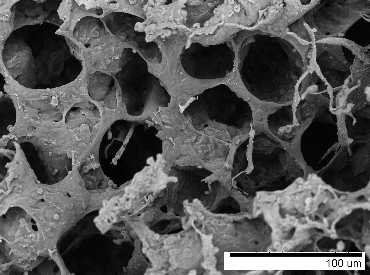 <strong>Figure 1.</strong> Alveolar tissue microstructure from a scanning electron microscope. Figure courtesy of the Computational Medicine Group at Pontificia Universidad Católica de Chile.