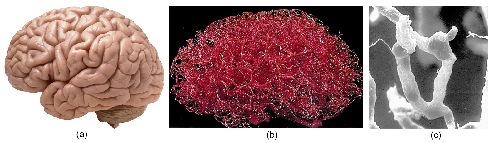 &lt;strong&gt;Figure 1.&lt;/strong&gt; The brain and its interlacing capillary network. &lt;strong&gt;1a.&lt;/strong&gt; The brain. &lt;strong&gt;1b.&lt;/strong&gt; The network of capillaries that intertwines the brain. &lt;strong&gt;1c.&lt;/strong&gt; Brain capillaries from the human cerebellar cortex. 1a and 1b are public domain images, and 1c is courtesy of [1].