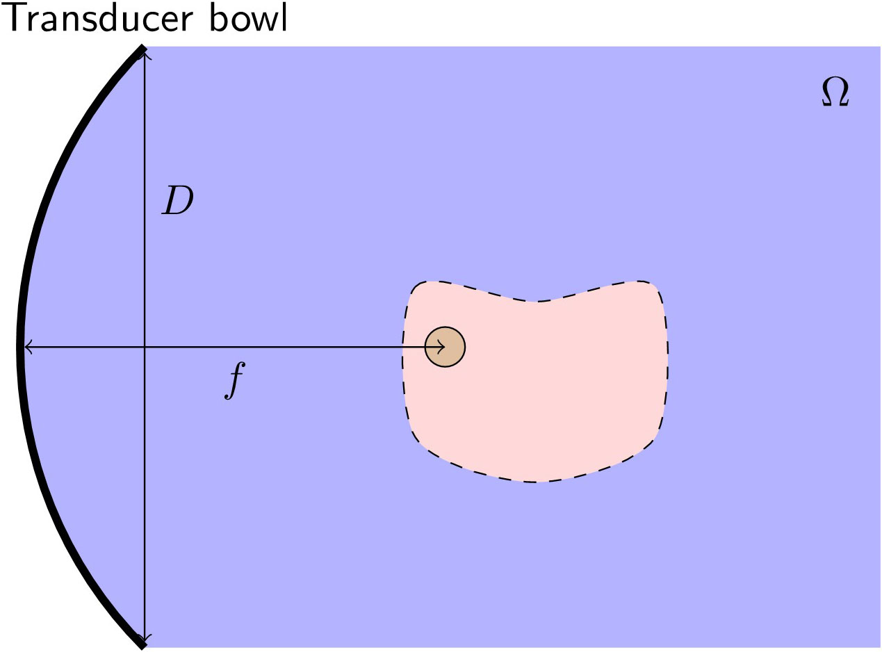 &lt;strong&gt;Figure 1.&lt;/strong&gt; Setup of a focused ultrasound treatment, where \(D\), \(f\), and \(\Omega\) respectively denote the transducer diameter, transducer focal length, and computational domain. The purple region represents the computational domain, the pink region represents the organ, and the brown region represents the tumor. Figure courtesy of the author.