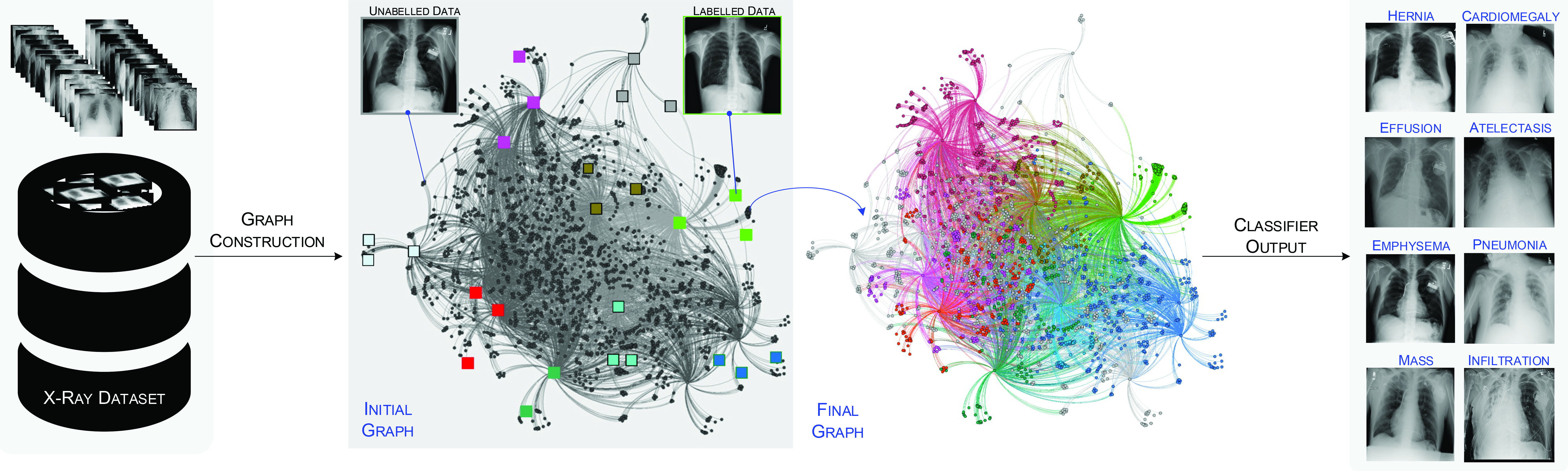 &lt;strong&gt;Figure 1.&lt;/strong&gt; Graph-based classification of chest X-rays into different pathologies. Based on only a very small number of labeled X-rays per class, researchers aim to classify the rest. To do so, they map the X-rays into a high-dimensional feature space where known labels are propagated to the unlabeled X-rays by the graph Laplacian. Figure courtesy of [1].