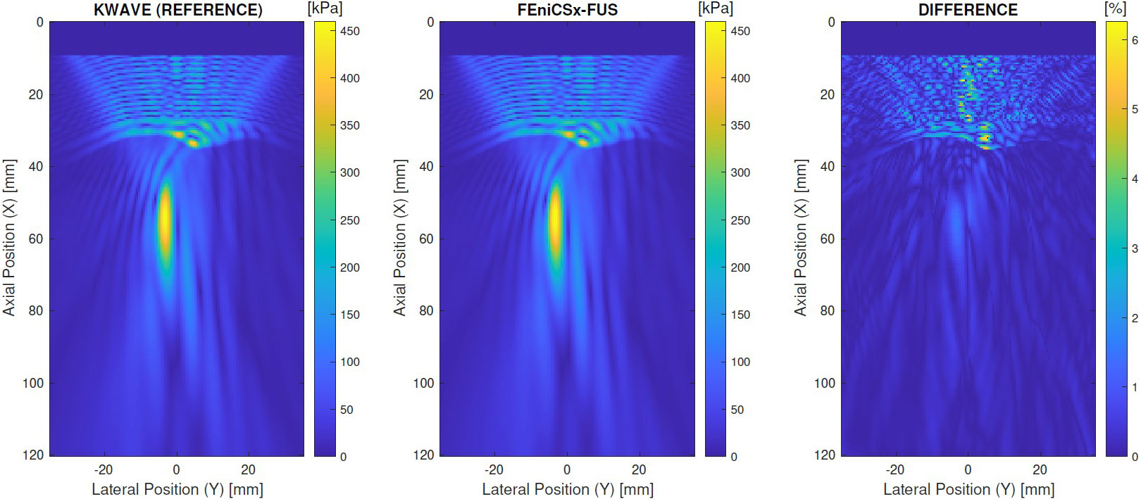 &lt;strong&gt;Figure 3.&lt;/strong&gt; Pressure amplitude comparison between the FEniCSx focused ultrasound (FUS) solver and the \(k\)-Wave solver, where the source transducer is a focused bowl transducer. The simulation depicts a two-dimensional slice of a three-dimensional simulation on a subset of a human skull. This comparison is based on benchmark simulations from [1]. Figure courtesy of the author.