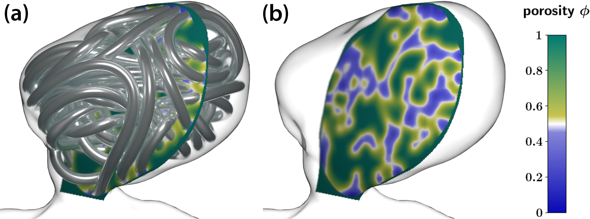 &lt;strong&gt;Figure 5.&lt;/strong&gt; Derivation/computation of a porosity field from a given coil geometry. &lt;strong&gt;5a.&lt;/strong&gt; A mechanically simulated coil geometry and a two-dimensional slice of its porous medium surrogate field \(\phi(\underline{x})\) within an aneurysm geometry. &lt;strong&gt;5b.&lt;/strong&gt; The same porosity field without the coil. Figure courtesy of the authors.