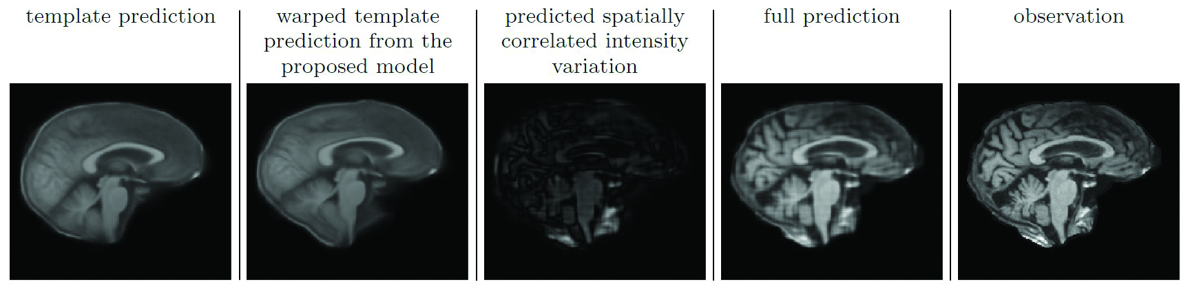 &lt;strong&gt;Figure 3.&lt;/strong&gt; Model predictions of a mid-sagittal brain slice (shown on the far right). From left to right: The estimated template for the proposed model, the warped template from the proposed model, the absolute value of the predicted spatially correlated intensity variation from the proposed model, and the full prediction. Image courtesy of [3].